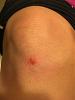 Click image for larger version. 

Name:	knee2.png 
Views:	471 
Size:	1.06 MB 
ID:	26536