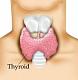 This is a group for patients that are battling thyroid diseases, including but not limited to: 
-Hashimoto's Thyroiditis 
-Graves Disease 
-Hyperthyroid/ Over Active Thyroid...